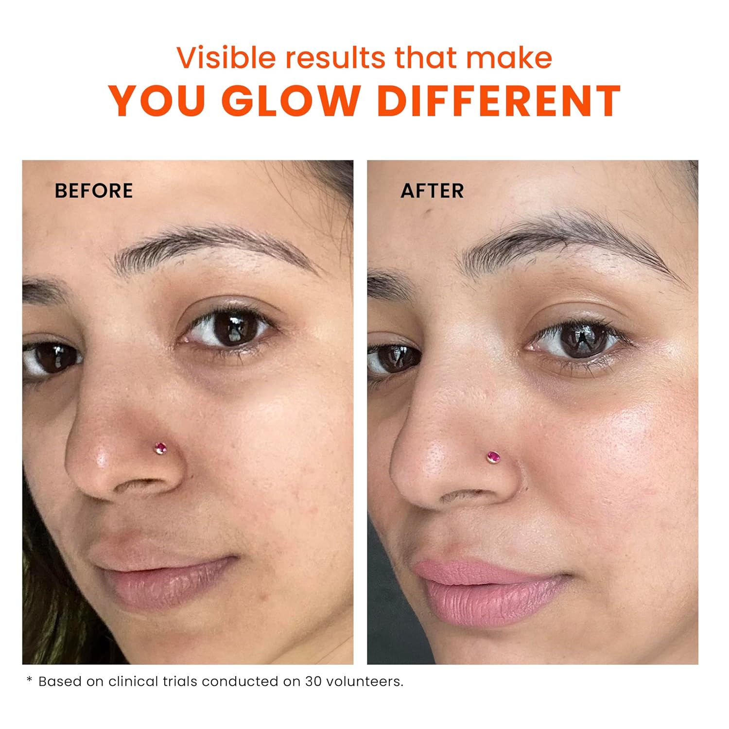 foxtale de tan face mask for glowing skin| clay mask with lactic acid for tan removal, reduction in blackheads, instant brightening| new age ubtan face pack for all skin types | men & women 75g foxtale de tan face mask for glowing skin| clay mask with lactic acid for tan removal, reduction in blackheads, instant brightening| new age ubtan face pack for all skin types | men & women 75g